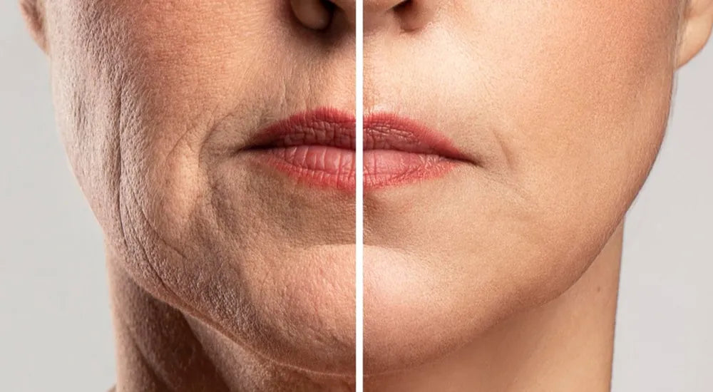 Say Good Bye to Wrinkles and Fine lines