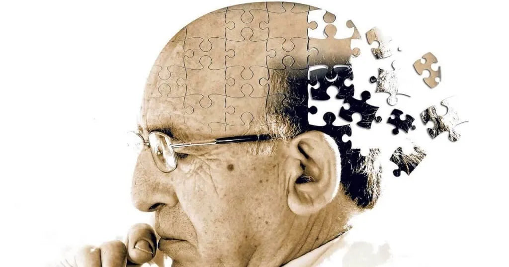 How to handle a person with Alzheimer’s